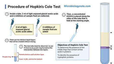 Hopkins Cole Test (Adamkiewicz–Hopkins) Principle, Procedure, .